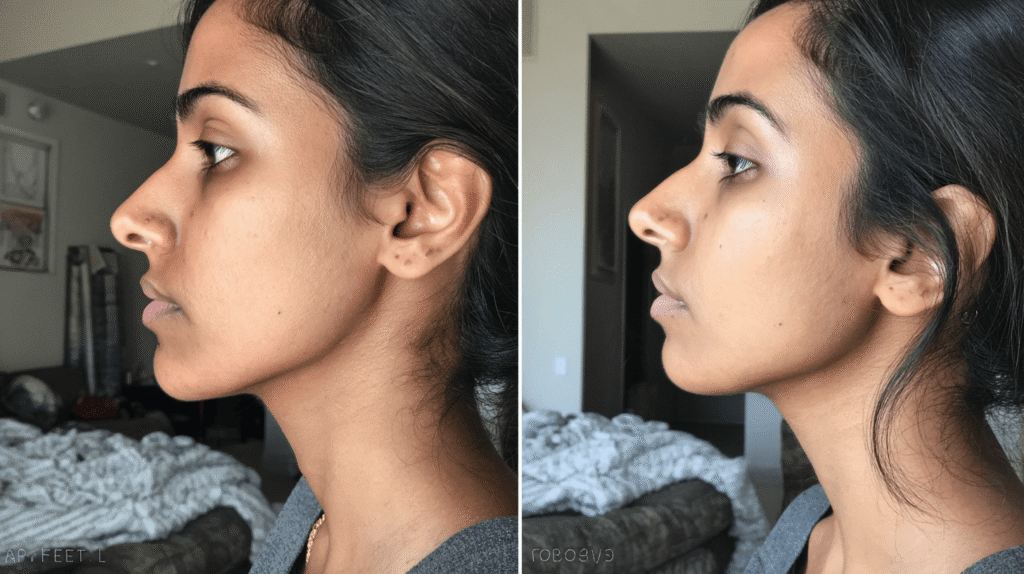 Before and after comparison – reduced dark spots