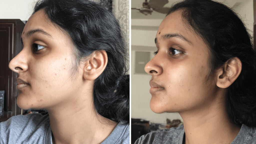 Visible brightening serum before and after